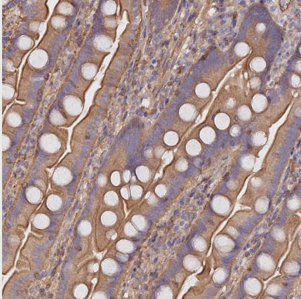 VPS18 Antibody