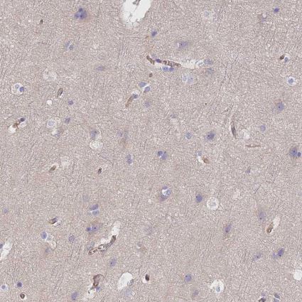 VPS18 Antibody