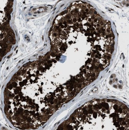 NUDCD3 Antibody - BSA Free
