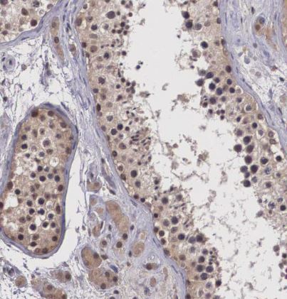 Vasohibin Antibody