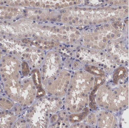 Vasohibin Antibody