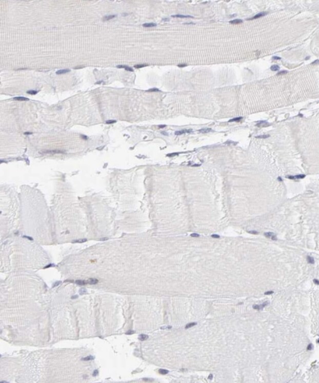OAS1 Antibody - BSA Free