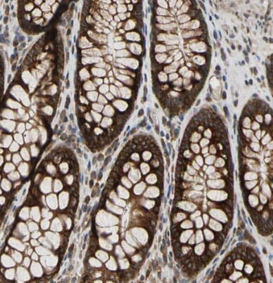 VAP-A Antibody - BSA Free