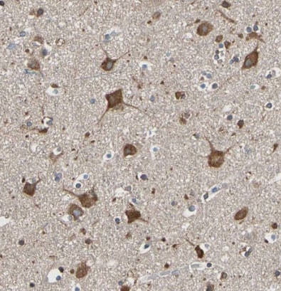 VAP-A Antibody - BSA Free