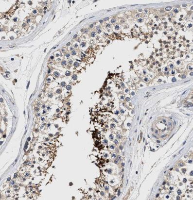 TEX2 Antibody