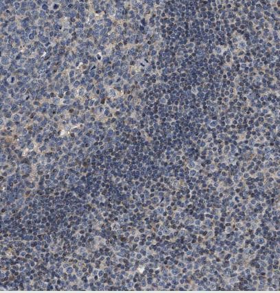 TEX2 Antibody