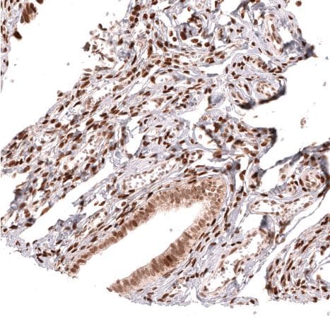 HOXA5 Antibody