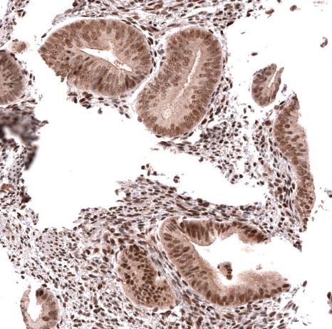 HOXA5 Antibody