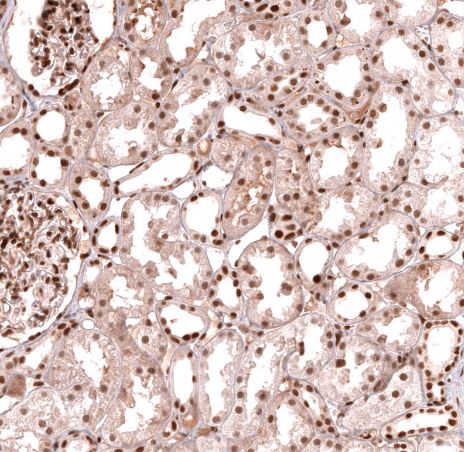 HOXA5 Antibody