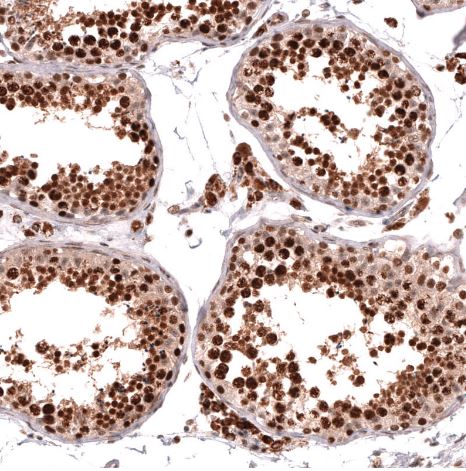 HOXA5 Antibody