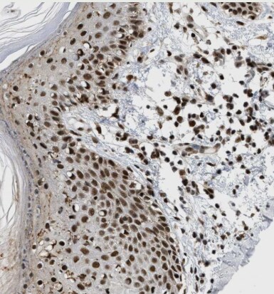 RBM5 Antibody - BSA Free