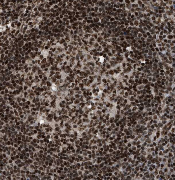 RBM5 Antibody - BSA Free