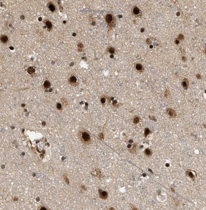 RBM5 Antibody - BSA Free