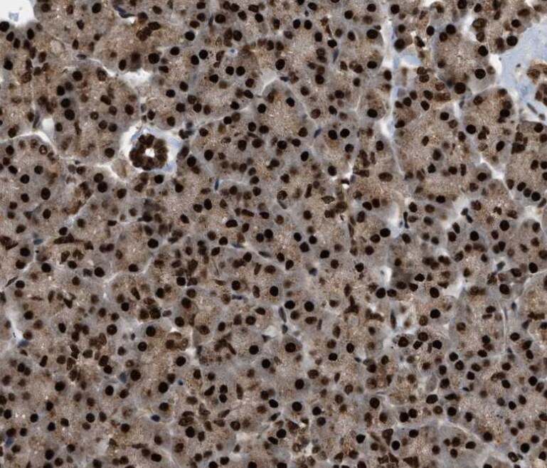 RBM5 Antibody - BSA Free