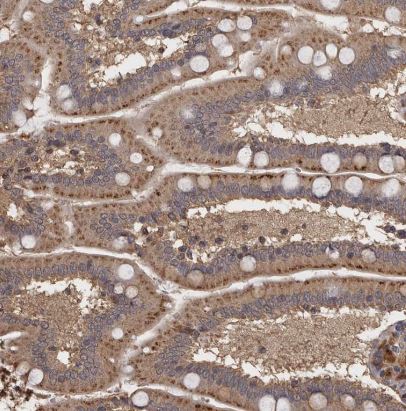 N-Acetylglucosaminyltransferase V/MGAT5 Antibody
