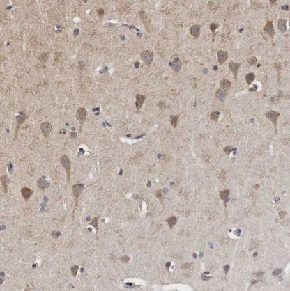 N-Acetylglucosaminyltransferase V/MGAT5 Antibody
