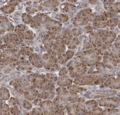 N-Acetylglucosaminyltransferase V/MGAT5 Antibody