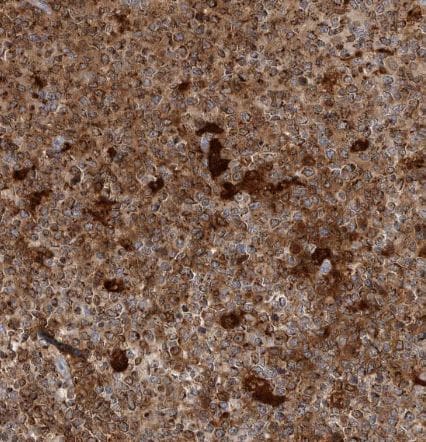 GILT/IFI30 Antibody