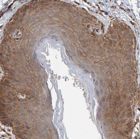 PLA2G3 Antibody