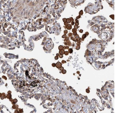 PLA2G3 Antibody