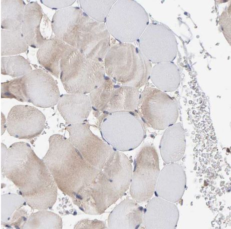PLA2G3 Antibody
