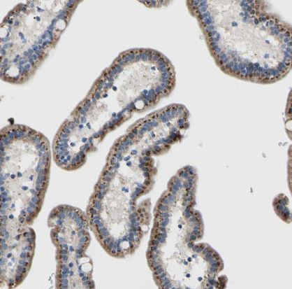 GALNT2 Antibody