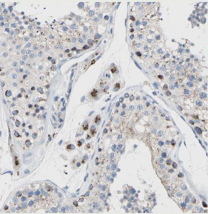 GALNT2 Antibody