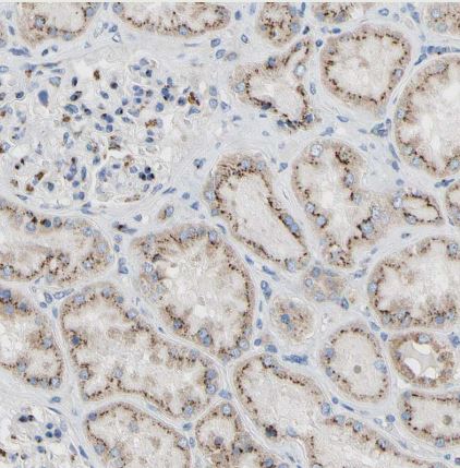 GALNT2 Antibody