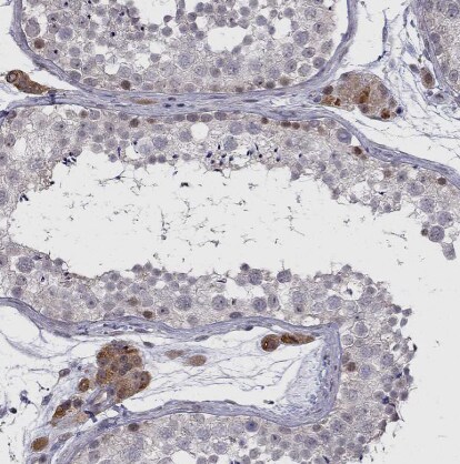 CHST8 Antibody