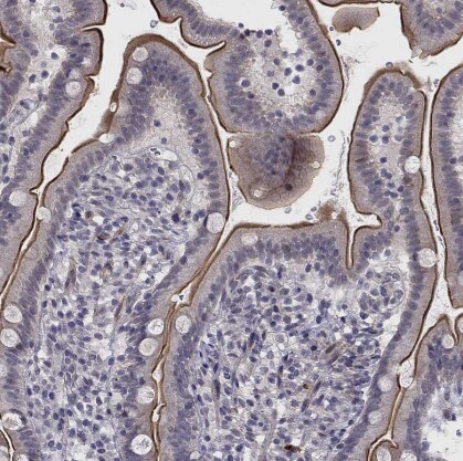 CHST8 Antibody