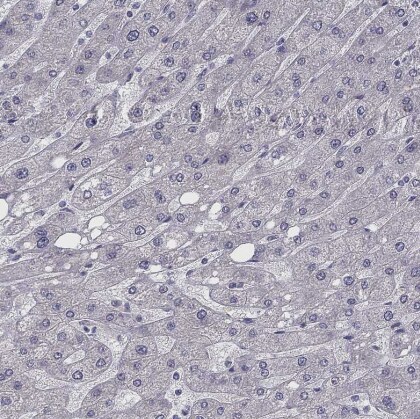 CHST8 Antibody