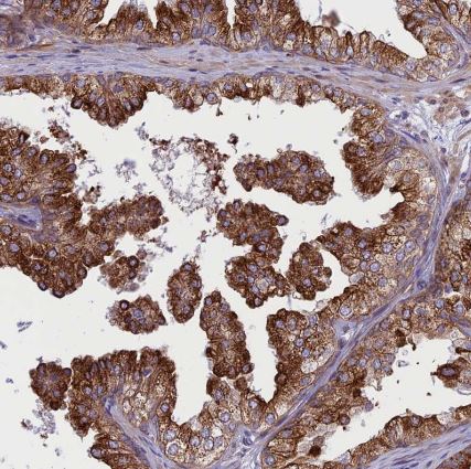 JMY Antibody