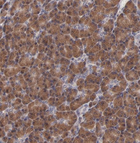 BAIAP2L2 Antibody BAIAP2L2 Antibody