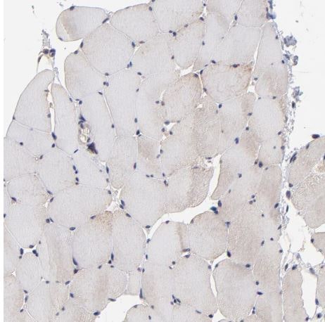 BAIAP2L2 Antibody BAIAP2L2 Antibody