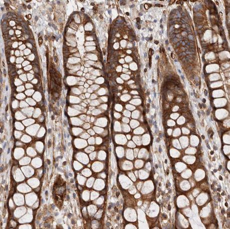 TMC7 Antibody