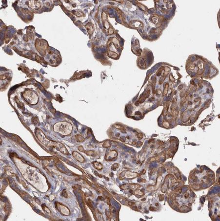 TMC7 Antibody