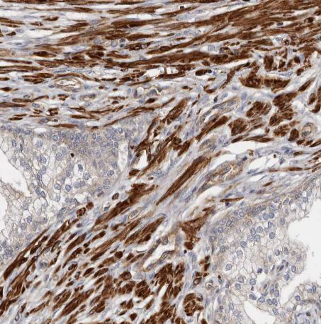 TMC7 Antibody