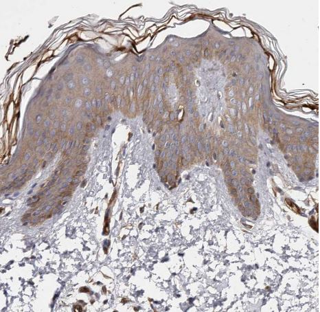 TMC7 Antibody