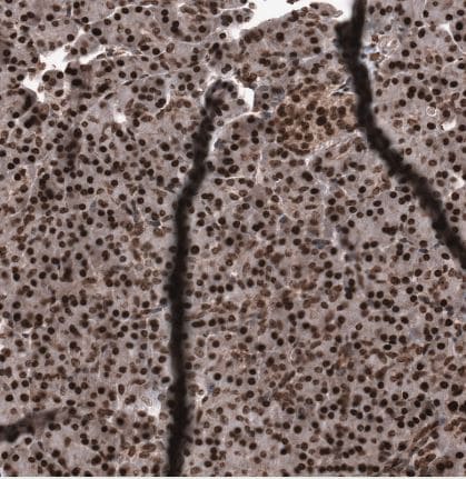 SNRK Antibody