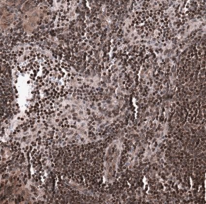 SNRK Antibody