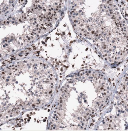 SNRK Antibody