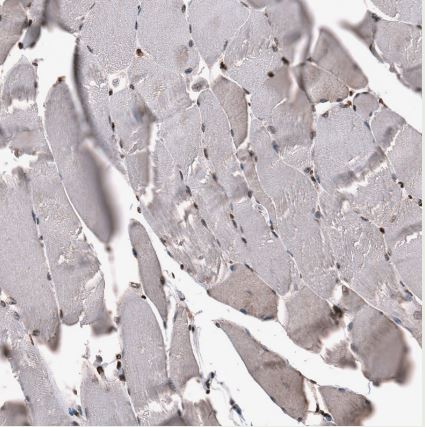 SNRK Antibody