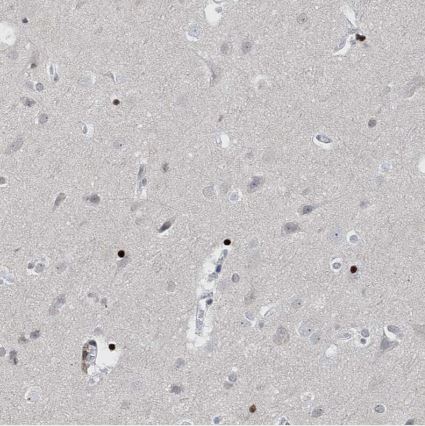 RFX7 Antibody