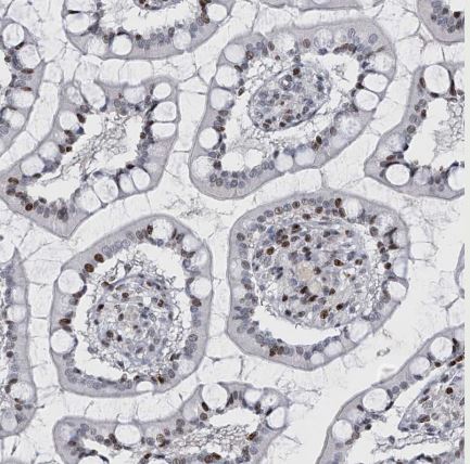 RFX7 Antibody