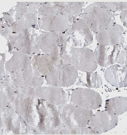 RFX7 Antibody