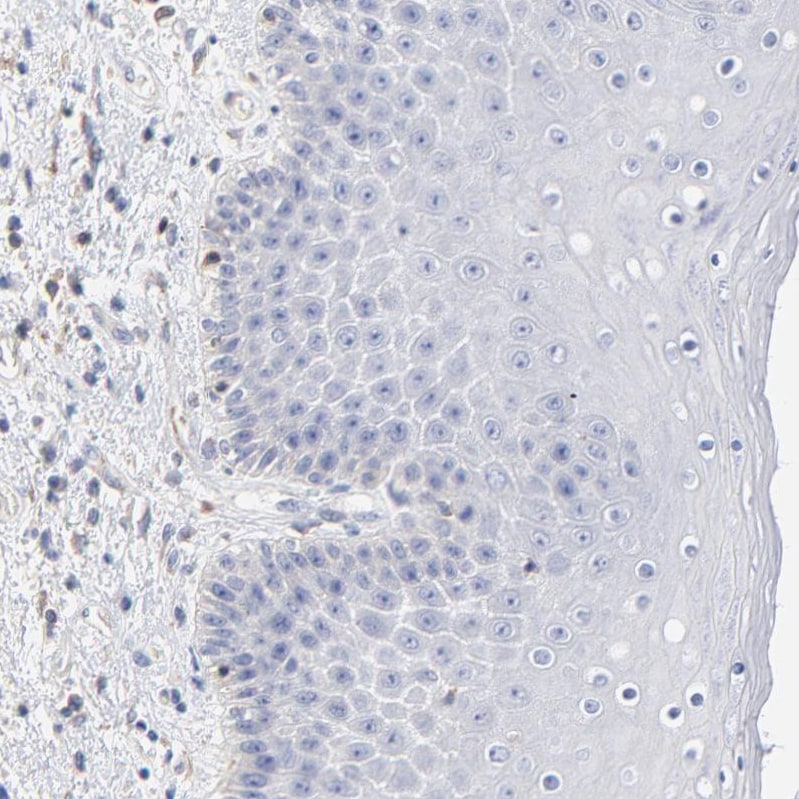 Septin-11 Antibody Immunohistochemistry-Paraffin: Septin-11 Antibody [NBP1-83824]