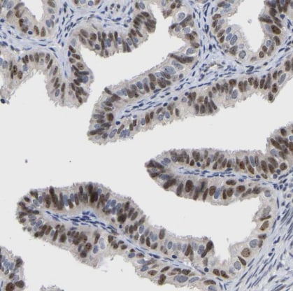 NLE1 Antibody