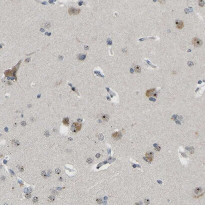 NLE1 Antibody