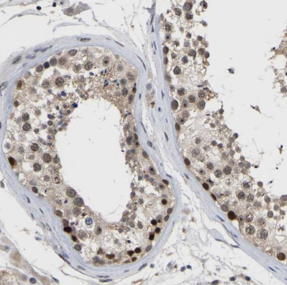 NLE1 Antibody