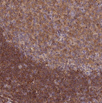 ARHGAP17 Antibody